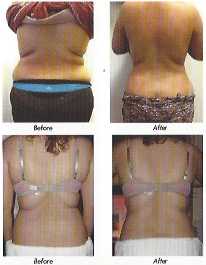 Neurotris Sculpting