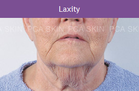 :axoty